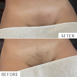 Melted Esthetic - Full Sugar Brazilian wax