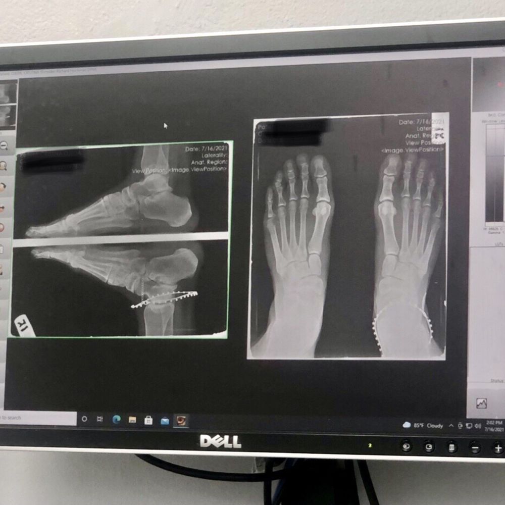 Richard Hochman, DPM - Podiatrists Near Me - Coral Gables, Florida Richard Hochman, DPM - Podiatrists Near Me - Coral Gables, Florida
