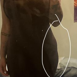 Chicago Breast & Body Aesthetics - 4 months post op