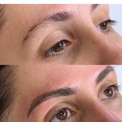 Simply Fresh Aesthetics - Before and after! Picture speaks for itself!