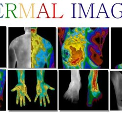 Brentwood Thermography Proactive Wellness & Imaging Center