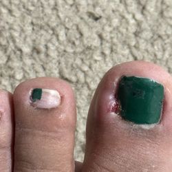 This is day 4 after my pedicure