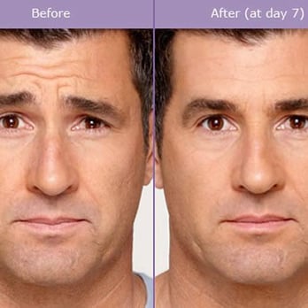 Brant Mozo, DDS - Oral Surgeons Near Me - Howell, New Jersey