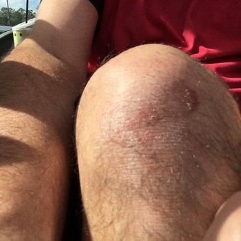 John Burge Park at Shadow Lakes - Sports injury - Parks Near Me - Conroe, Texas
