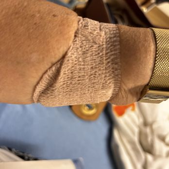 Trusted Medical Centers Mansfield - First attempt at an IV, it blew the vein. - Emergency Rooms Near Me - Mansfield, Texas Trusted Medical Centers Mansfield - First attempt at an IV, it blew the vein. - Emergency Rooms Near Me - Mansfield, Texas