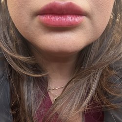 Fayced Aesthetics NYC - Lips