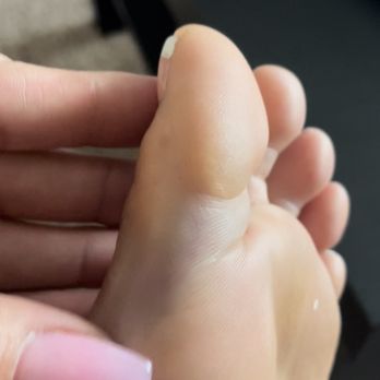 Classy Nails Spa - Hurt toe - Nail Salons Near Me - Scottsdale, Arizona
