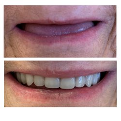 Columbia Basin Denture Care