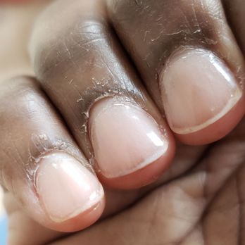 99 Elegant Nail - Cuticles healing after being drilled too closely. - Nail Salons Near Me - Douglasville, Georgia 99 Elegant Nail - Cuticles healing after being drilled too closely. - Nail Salons Near Me - Douglasville, Georgia