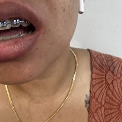 Diamond Braces