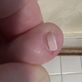 Allure Nails & Spa - Another toe he cut me . - Nail Salons Near Me - Coral Springs, Florida Allure Nails & Spa - Another toe he cut me . - Nail Salons Near Me - Coral Springs, Florida