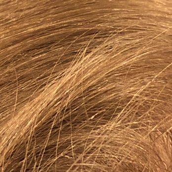 Comb It Out Lice Removal - Lots of nits left behind after costly combing. - Lice Services Near Me - Concord, California