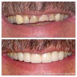 Glendora Dental