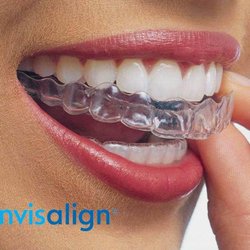 Gabriel Enriquez, DDS MS - Humboldt Orthodontics - It doesn't have to be braces! We are the premier local Invisalign provider.