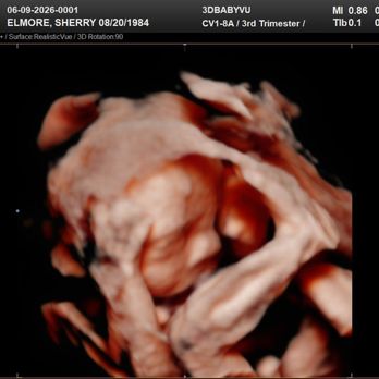 3DBabyVu - Ultrasound Imaging Centers Near Me - Pleasanton, California 3DBabyVu - Ultrasound Imaging Centers Near Me - Pleasanton, California