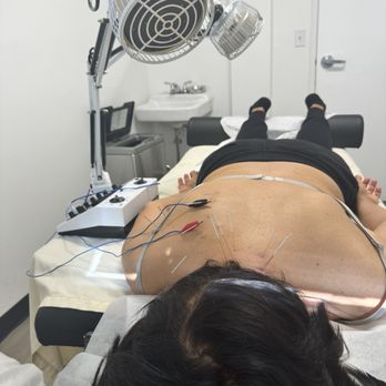 Northridge Acupuncture - Acupuncture Near Me - Reseda, California