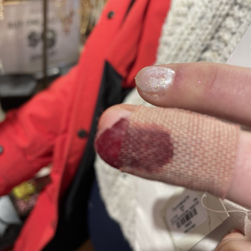 Bleeding finger after manicurist cut it with cuticle tool Bleeding finger after manicurist cut it with cuticle tool