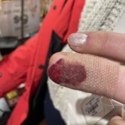 Luxury Nails - Bleeding finger after manicurist cut it with cuticle tool