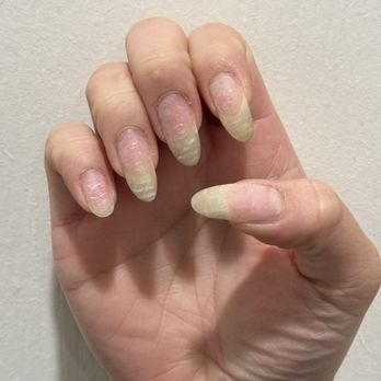 Kitchen Nail Bar - Sunnyvale - Pinky nail cut short to the nail bed without asking or saying ANYTHING first - Nail Salons Near Me - Sunnyvale, California Kitchen Nail Bar - Sunnyvale - Pinky nail cut short to the nail bed without asking or saying ANYTHING first - Nail Salons Near Me - Sunnyvale, California