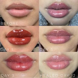 Lip Blushd by Yvon transformation Lip Blushd by Yvon transformation