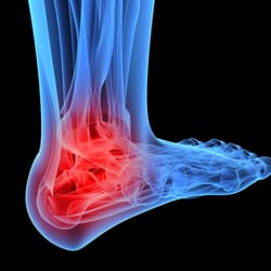 Advanced Foot & Ankle Care Specialists - Help for your painful feet