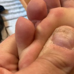 South County Health Urgent/ Walk-In Care - No infection. Anyone see something wrong with that diagnosis.