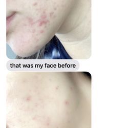 Luxe Esthetics By Michelle - Client