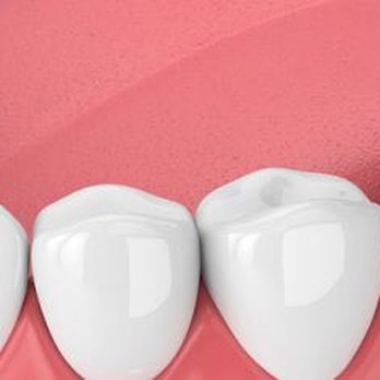 Jérémie Bejnbaum - Implant dentaire - Oral Surgeons Near Me - Paris, 75