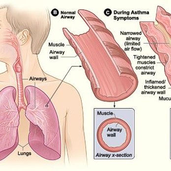 Thomas Chacko, MD - Allergists Near Me - Atlanta, Georgia