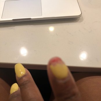 Express Nail Spa - My nail that I had to remove myself because it was hurting too bad to keep it on. This is after 2 days of getting a fill in - Nail Salons Near Me - Brandywine, Maryland