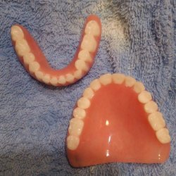 NDX Green - The top Dentures are completely different once returned after being finalized than they were during wax tryin.