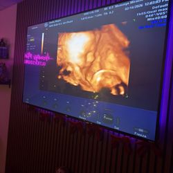 Mommys Miracle Ultrasound