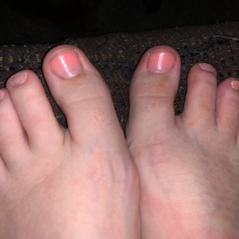 Splendid Nails - This is how my toes looked when I left the shop - Nail Salons Near Me - Kannapolis, North Carolina Splendid Nails - This is how my toes looked when I left the shop - Nail Salons Near Me - Kannapolis, North Carolina