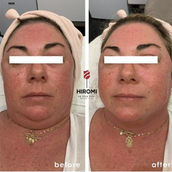 La Peau Rose - Skin Care Near Me - Lewisville, Texas La Peau Rose - Skin Care Near Me - Lewisville, Texas