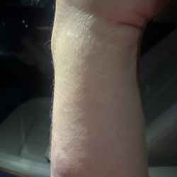 Ochsner Urgent Care - My wrist!