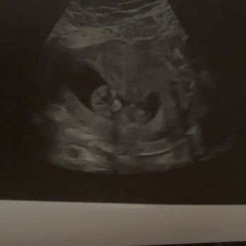 Unique Ultrasound - Diagnostic Imaging Near Me - Temecula, California Unique Ultrasound - Diagnostic Imaging Near Me - Temecula, California
