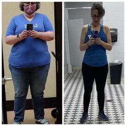Arch Bariatrics - Front view May 2021 and September 2022