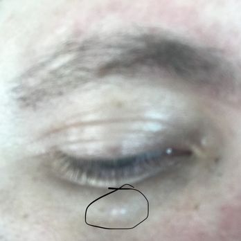 Eric J Meinhardt, MD, FAAD - Dermatologists Near Me - Los Angeles, California Eric J Meinhardt, MD, FAAD - Dermatologists Near Me - Los Angeles, California
