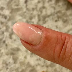 Jacqueline's Day Spa & Salon - My nail 3 days after a "manicure" at Jacqueline's Day Spa. Notice the bubbles??