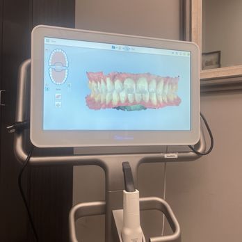 Ideal Dental Georgetown - 3D screening of teeth - General Dentistry Near Me - Georgetown, Texas Ideal Dental Georgetown - 3D screening of teeth - General Dentistry Near Me - Georgetown, Texas