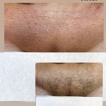 Studio61 On The Go - Brazilian wax - Waxing Near Me - Bakersfield, California Studio61 On The Go - Brazilian wax - Waxing Near Me - Bakersfield, California