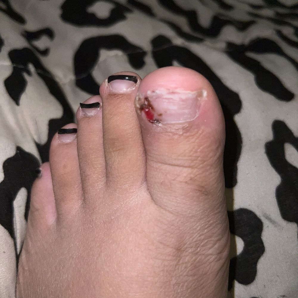 Do not come here if you don't want your toe to look like this .