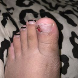 Do not come here if you don't want your toe to look like this . Do not come here if you don't want your toe to look like this .