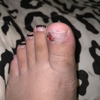 Angel Spa & Nails - Do not come here if you don't want your toe to look like this . - Nail Salons Near Me - Apple Valley, California Angel Spa & Nails - Do not come here if you don't want your toe to look like this . - Nail Salons Near Me - Apple Valley, California