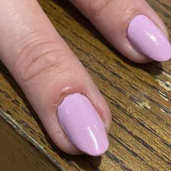 La Queen Nails - Right middle finger cuticle destroyed and infected - Nail Technicians Near Me - Queens, New York