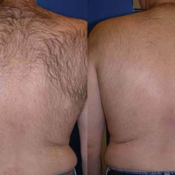 Green Clinic - laser hair removal - Skin Care Near Me - Toronto, Ontario Green Clinic - laser hair removal - Skin Care Near Me - Toronto, Ontario
