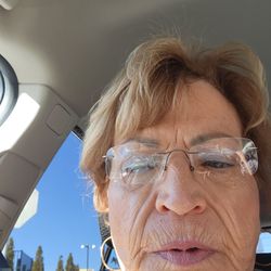 Richmond Plastic Surgeons - Bad face-lift!! Don't go to dr. Wornam
