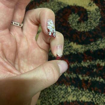 Family Nails - Broken nail. - Nail Salons Near Me - Mastic, New York Family Nails - Broken nail. - Nail Salons Near Me - Mastic, New York