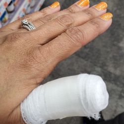 O Baby Nail - My trip to Urgent Care to have my thumb drained after getting an infection from this place!