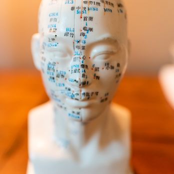 Acupuncture Solutions - Acupuncture Near Me - Naples, Florida Acupuncture Solutions - Acupuncture Near Me - Naples, Florida